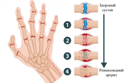 Татуировка на пальцах - делать или нет | Блог о тату