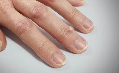 Лечение боли в пальцах рук в клинике Март в Санкт-Петербурге