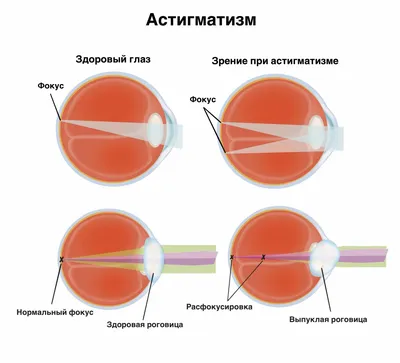 3D изображения