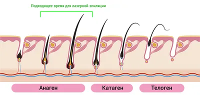 Лазерная эпиляция ног с помощью LightSheer DUET — Сеть косметологических  клиник Эпилайк