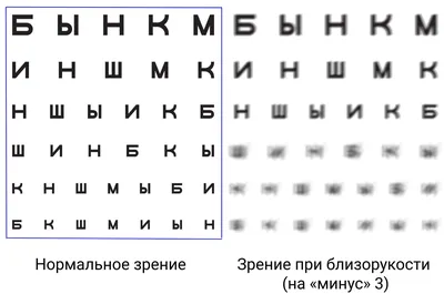 Как видит человек со зрением минус 3 — можно ли восстановить, обязательно  ли носить очки, как лечить