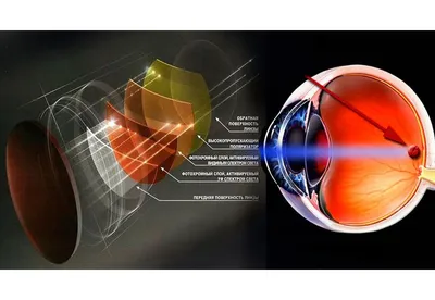 Как сохранить зрение | Школа офтальмологии