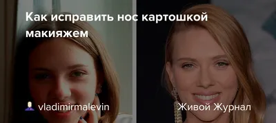 Звезды до и после пластики носа: фото знаменитостей - 300 экспертов.РУ