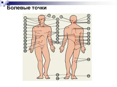 Триггерные точки в средней ягодичной мышце | Здоровье с нами | Дзен