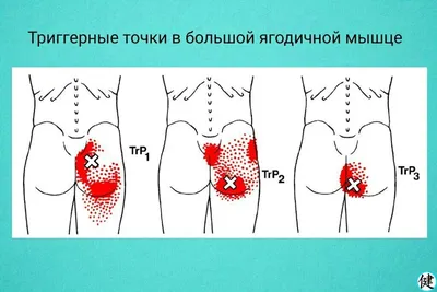 Точечный массаж спины: схемы и техники выполнения