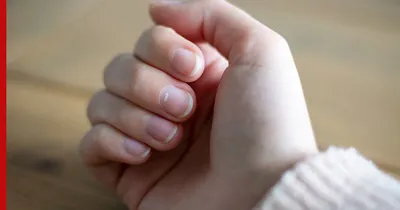 Обработка ногтевой пластины с онихомикозом в Хабаровске