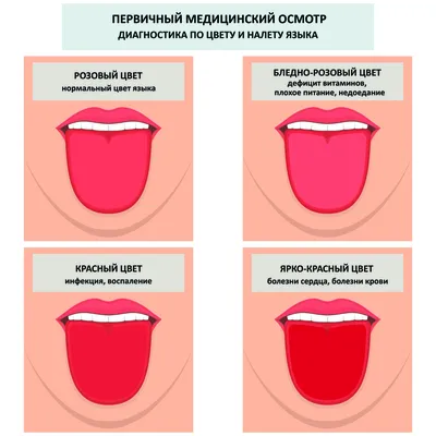 Стоматит: лечение, симптомы, виды, признаки у взрослых и детей