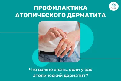 атопический дерматит женщина смотрит на красные и потрепанные руки с  сильной аллергией Стоковое Фото - изображение насчитывающей рука, сух:  215878252