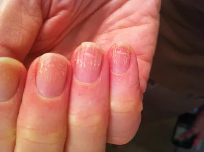 Девушке занесли грибок ногтей в маникюрном салоне Новосибирска | ОБЩЕСТВО |  АиФ Новосибирск