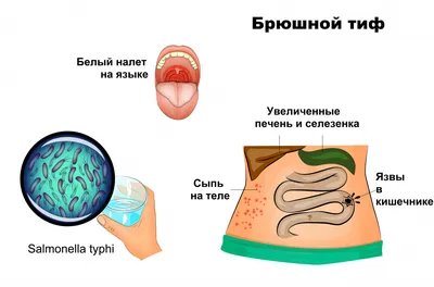 Селфхарм: когда душевные раны превращаются в раны на теле | Ганцавіцкі час