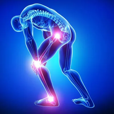 Почему болять колени. Как поддержать здоровье коленного сустава в пожилом  возрасте: пансионаты Опека в Санкт-Петербурге