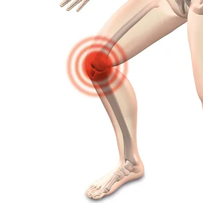 Стояние на коленях — Википедия