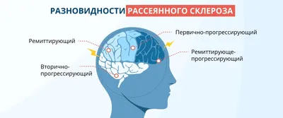 Купить Ионообменная смола ПЮРЕЗИН РС 002 по выгодной цене в официальном  интернет-магазине «Гейзер»