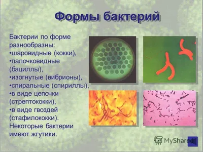 Бесплатные стоковые фото на тему covid 19, бактериальный, бактерии,  безопасность, биология, болезнь, вирус, возвеличил, вспышка, глобальный,  графический дизайн, заболевание, заразительный, изоляция, инфекционное  заболевание, карантин, клетка ...