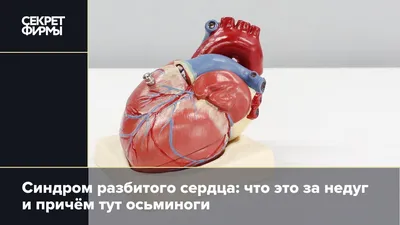 Разбитое сердце карандашом - 62 фото