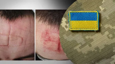 Израильский журналист опубликовал фото украинского солдата с нашивкой в  виде свастики - Газета.Ru | Новости
