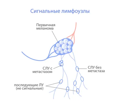 Причины увеличения лимфоузлов. | Дарья Кобец. Врач-онколог химиотерапевт |  Дзен