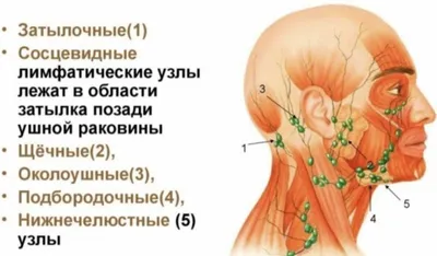 Воспаление лимфоузлов: причины, симптомы, лечение - Телеграф