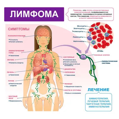 Биопсия сигнального лимфатического узла | Frau Klinik - клиника  пластической хирургии и косметологии