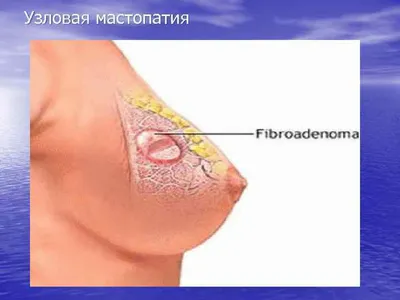 Проекции внутренних органов на стопе | Лимфатическая система, Массаж,  Альтернативное лечение