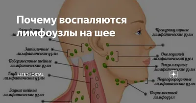 Почему воспаляются лимфоузлы на шее | ESTET-PORTAL | Дзен