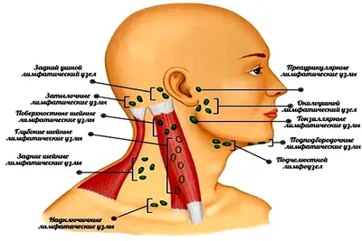 НЕМНОГО ПРО ЛИМФОУЗЛЫ! - Oncohelp