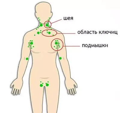 Из-за чего увеличиваются лимфоузлы: 5 причин - Здоровье 24