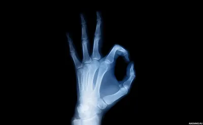 Рука под рентгеном с жестом OK, означающим, что излучение в порядке — Фото  на аву