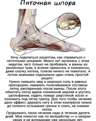 Женские и мужские силиконовые гелевые пяточные чашечки, пятка, подушечки,  стельки для подошвенного фасциита, пяточные шпоры, пятка, искусство ухода |  AliExpress