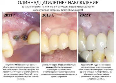 Шпаргалки для мамы Головоломки из спичек логические задания для детей