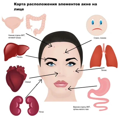 Угри на лице: как легко и просто решить проблему | Женский мир: Инсайты и  вдохновение | Дзен