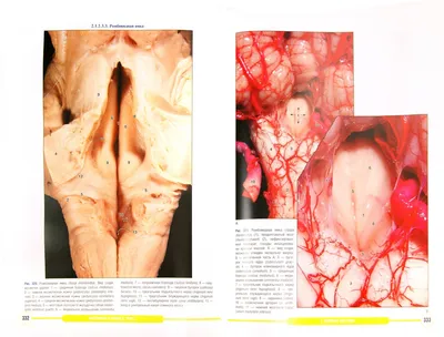 Тест на внимательность: угадай 5 внутренних органов по картинке |  DOCTORPITER