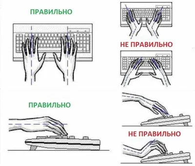 Остерегайтесь остеохондроза, если часто работаете за компьютером - Computer  Service Троещина