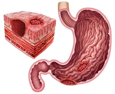 желудок человека с печенью на 3d модели, фото где находится поджелудочная  железа, анатомия, поджелудочная железа фон картинки и Фото для бесплатной  загрузки