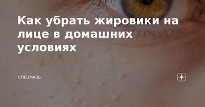 Что такое милиумы, или просянки? Почему они появляются и как избавиться от  просянок | Портал 1nep.ru