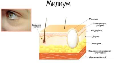 ➡️Милиумы на лице. Что это.... - Центр Красоты и Эстетики | Facebook